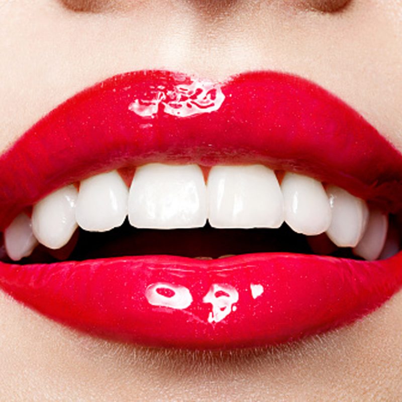 Dental Veneers Park Dental Clinic Kusadasi, Dentist clinics in Kusadasi