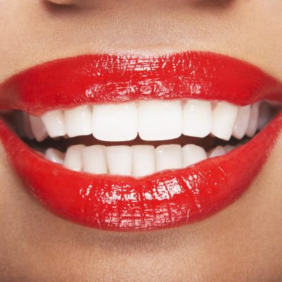 Zirconium Teeth in Kusadasi